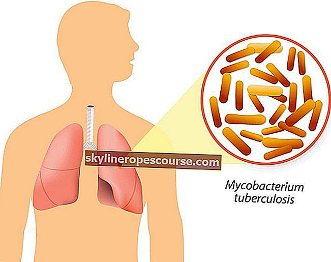 
   Spriječiti TB za uklanjanje TB
  